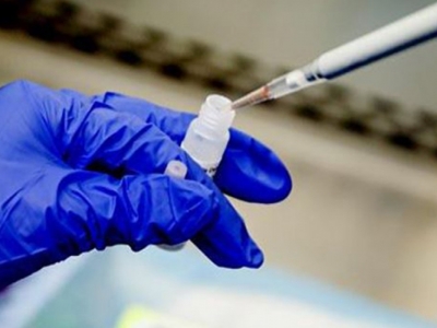 15 dakikada koronavirüs testi!