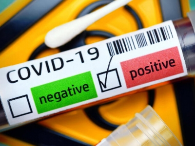 60 derece sıcaklığa maruz bırakılan koronavirüs...