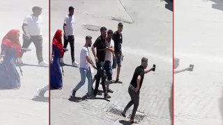 Urfa'da Ayağından Vuruldu