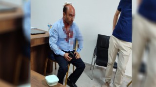 Şanlıurfa’da okul müdürüne kemik kıranla saldırı!